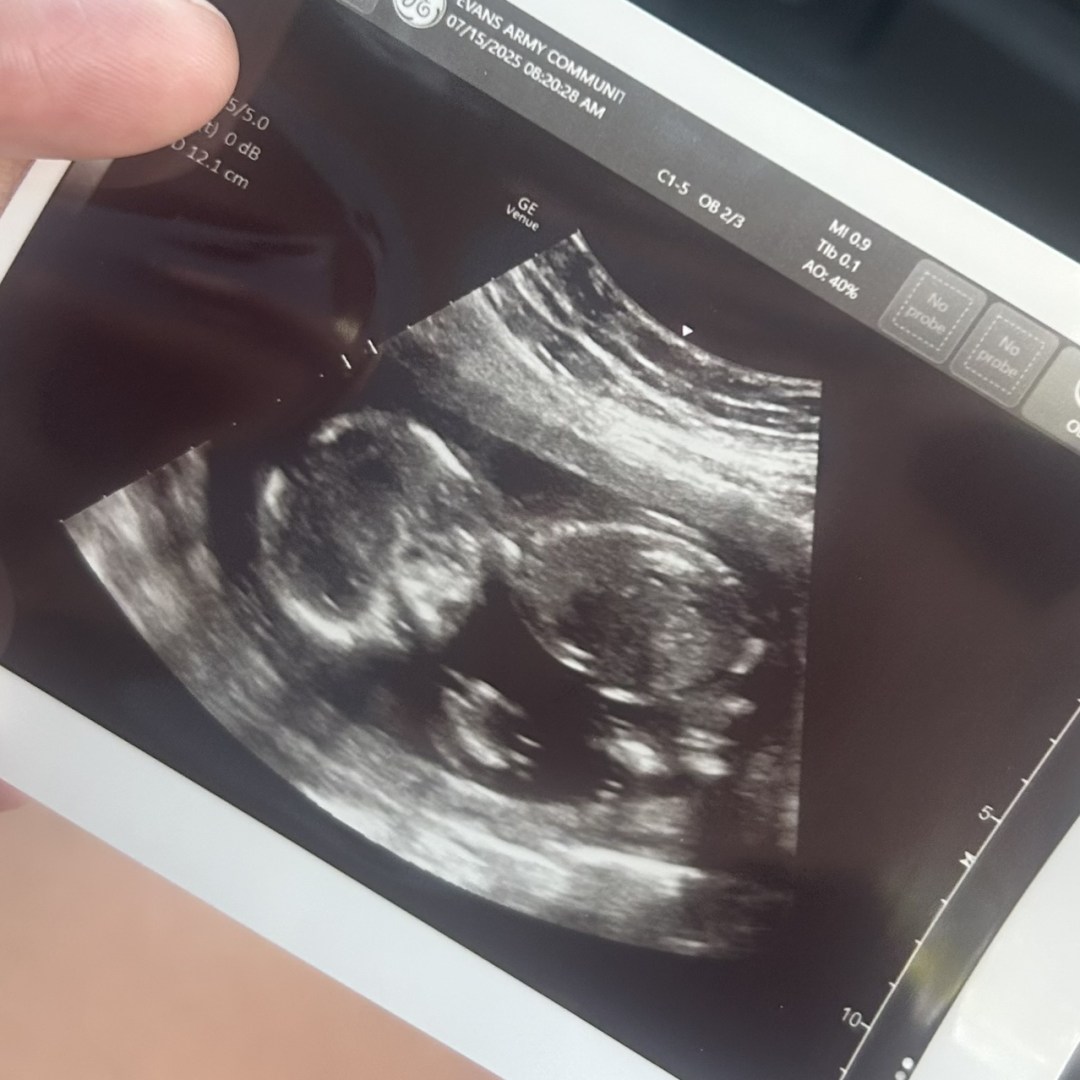 Photo shared by Tamira for their Babylist baby registry.