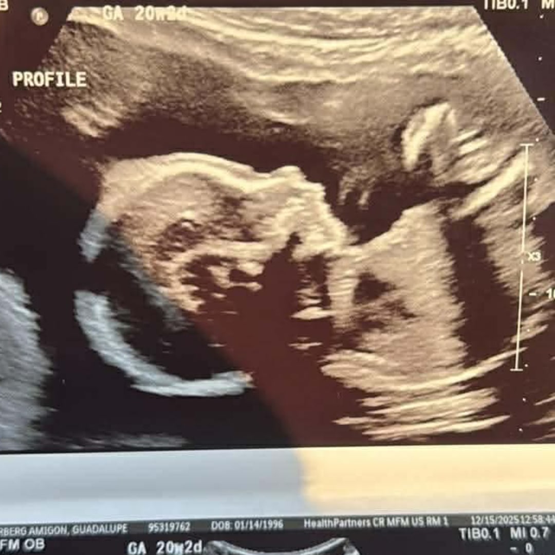 Photo shared by Lupe for their Babylist baby registry.