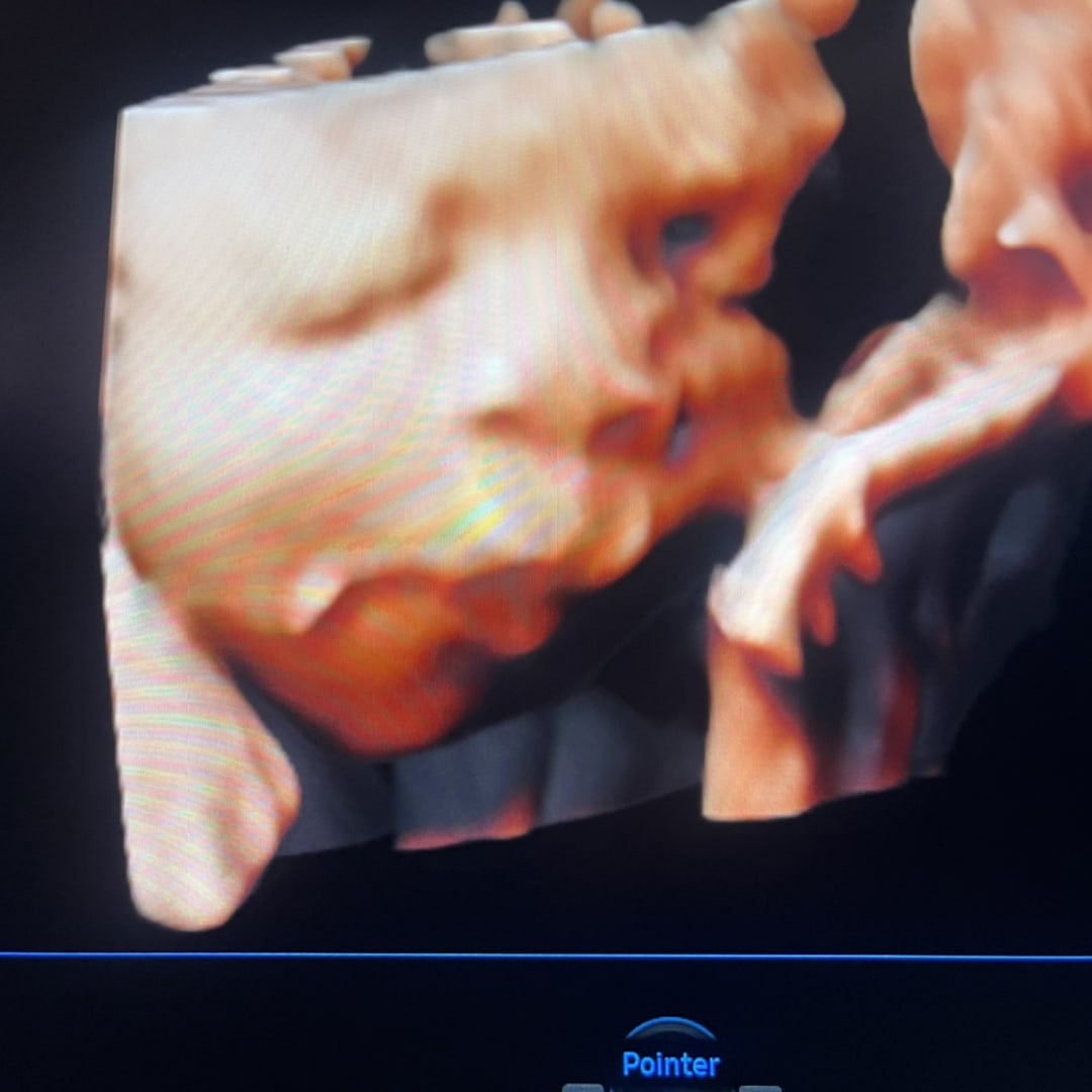 Photo shared by Zyreah for their Babylist baby registry.