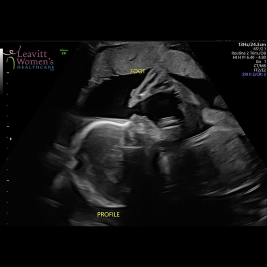 Photo shared by Rylee for their Babylist baby registry.