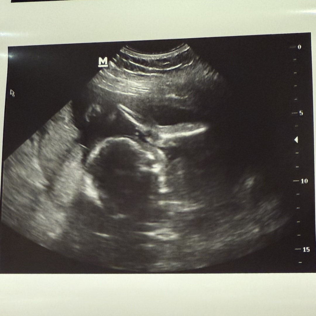 Photo shared by Carolina for their Babylist baby registry.