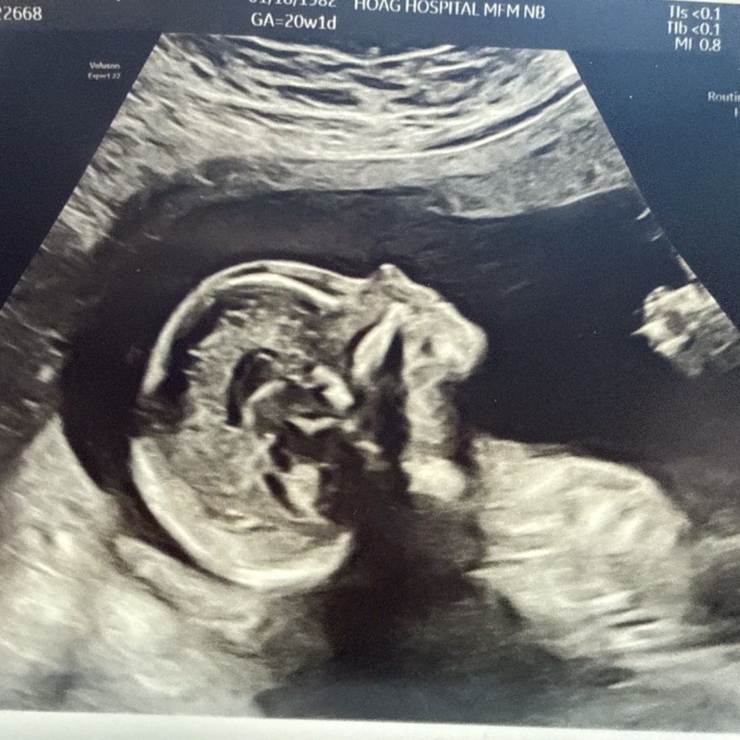 Photo shared by Andrea for their Babylist baby registry.