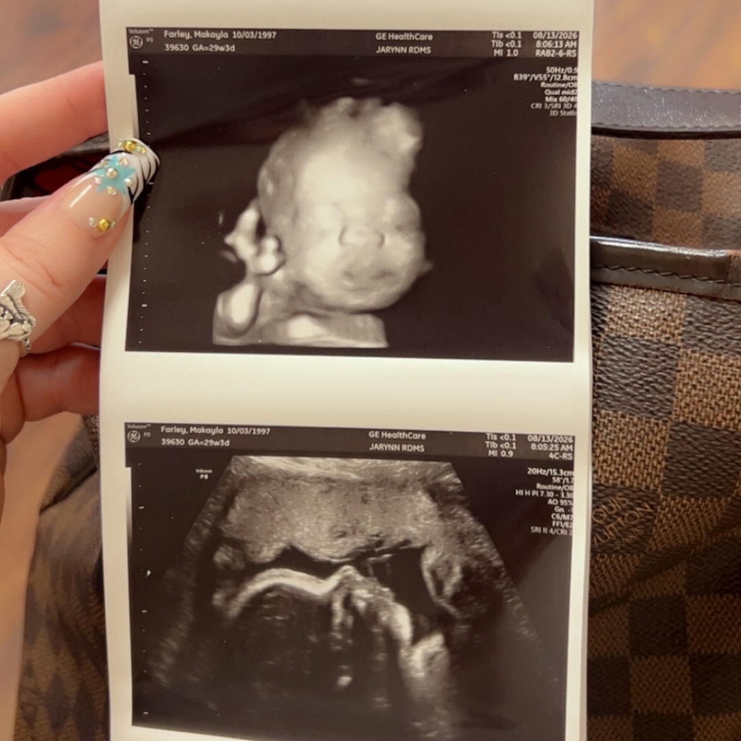Photo shared by Makayla for their Babylist baby registry.