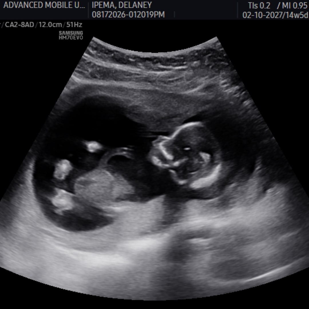 Photo shared by Delaney for their Babylist baby registry.