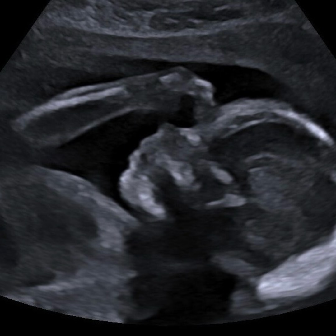 Photo shared by Hannah Bo for their Babylist baby registry.