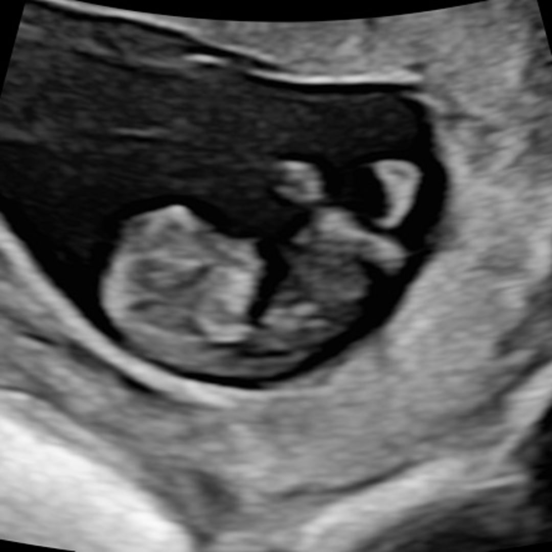 Photo shared by Julia for their Babylist baby registry.