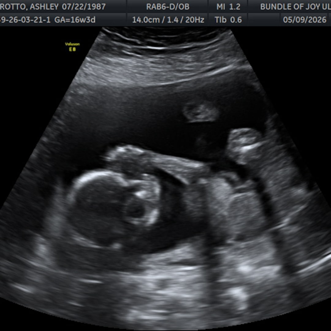 Photo shared by Ashley & Dan for their Babylist baby registry.