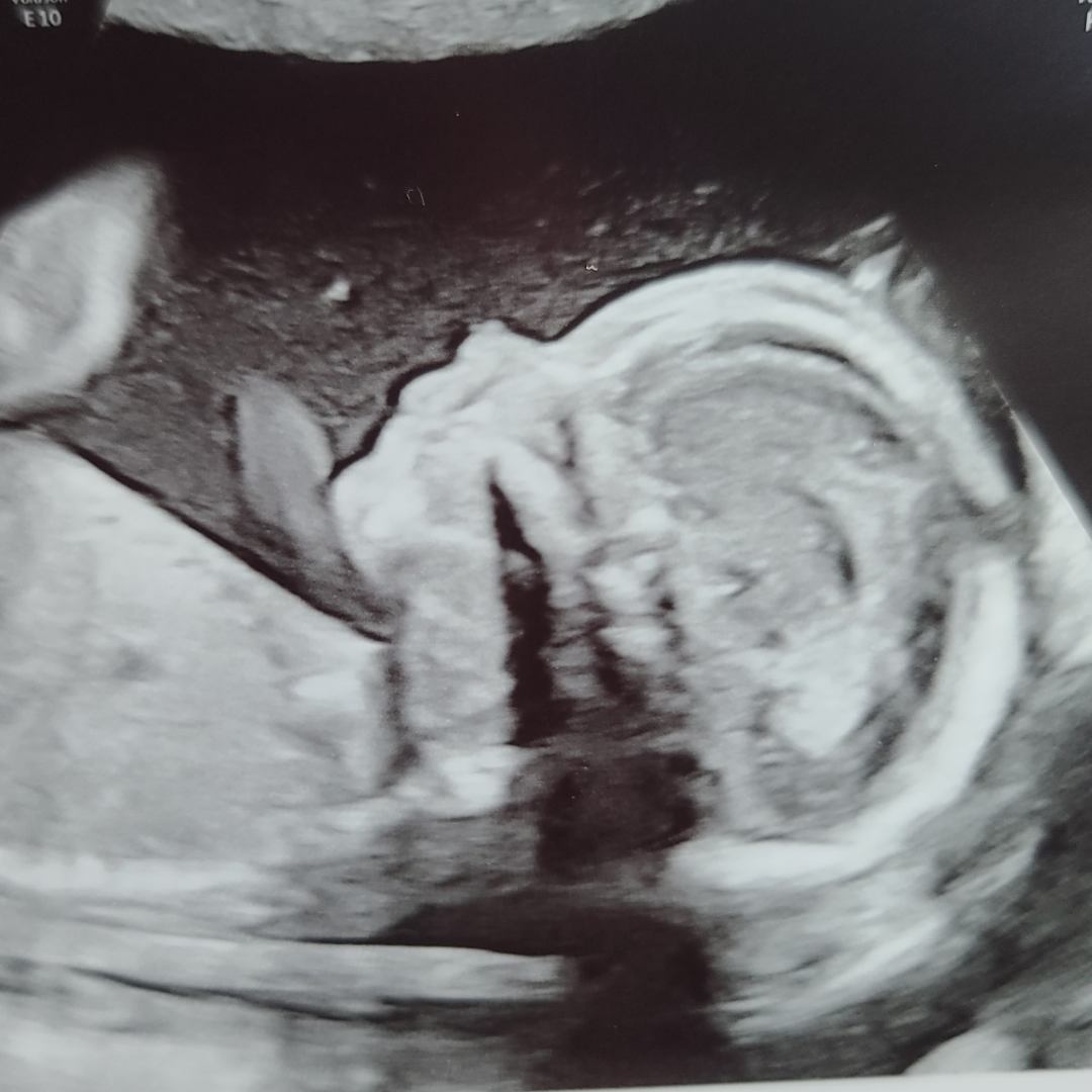 Photo shared by Kelsie for their Babylist baby registry.