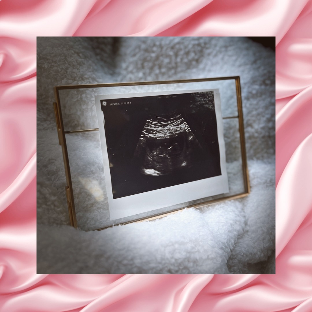 Photo shared by Avery for their Babylist baby registry.