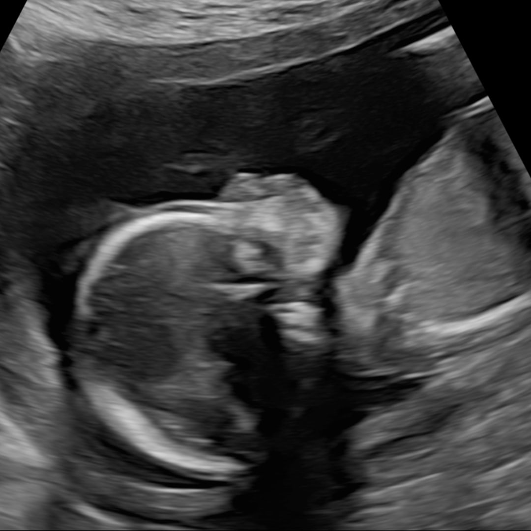 Photo shared by Denisha for their Babylist baby registry.