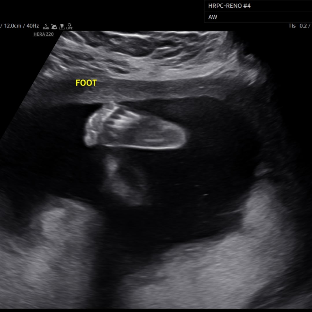 Photo shared by Skye for their Babylist baby registry.