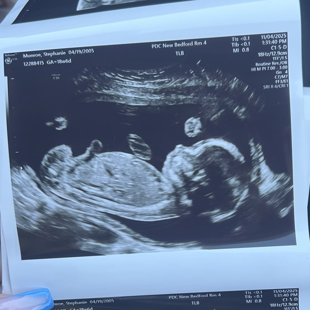 Photo shared by Stephanie for their Babylist baby registry.