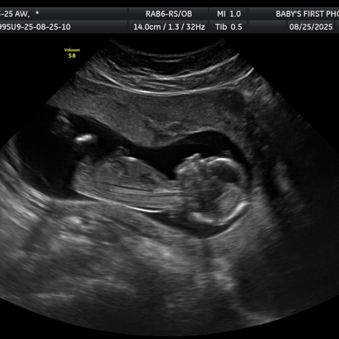 Photo shared by Amy for their Babylist baby registry.