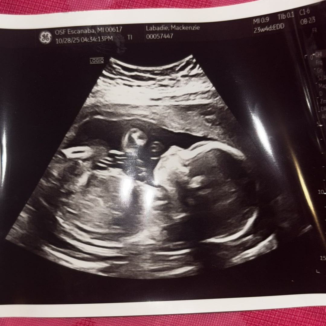 Photo shared by Mackenzie for their Babylist baby registry.