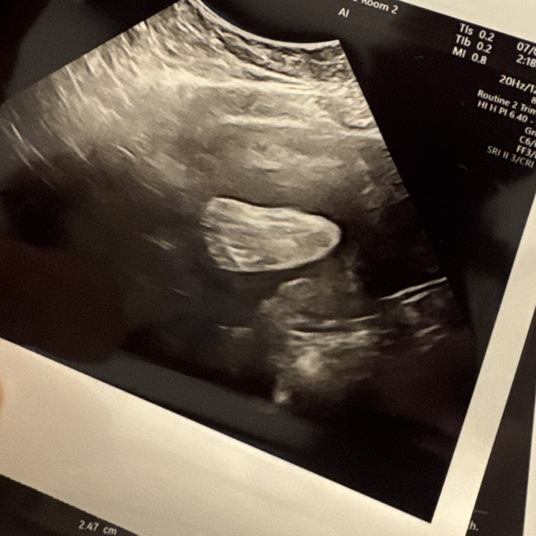 Photo shared by Bailey for their Babylist baby registry.