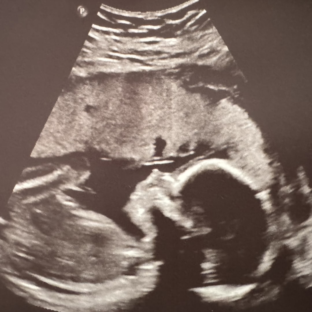 Photo shared by Allie & Brett for their Babylist baby registry.