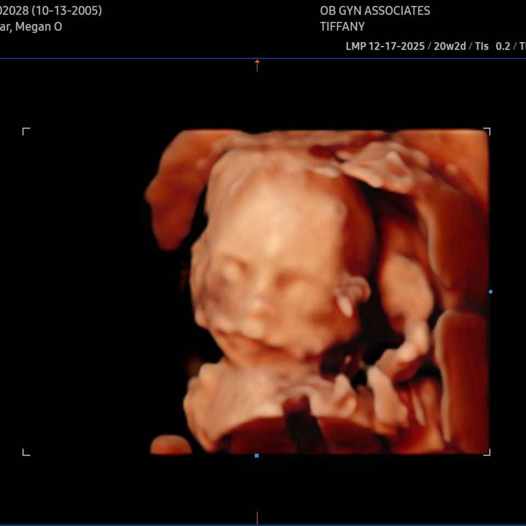 Photo shared by Megan for their Babylist baby registry.