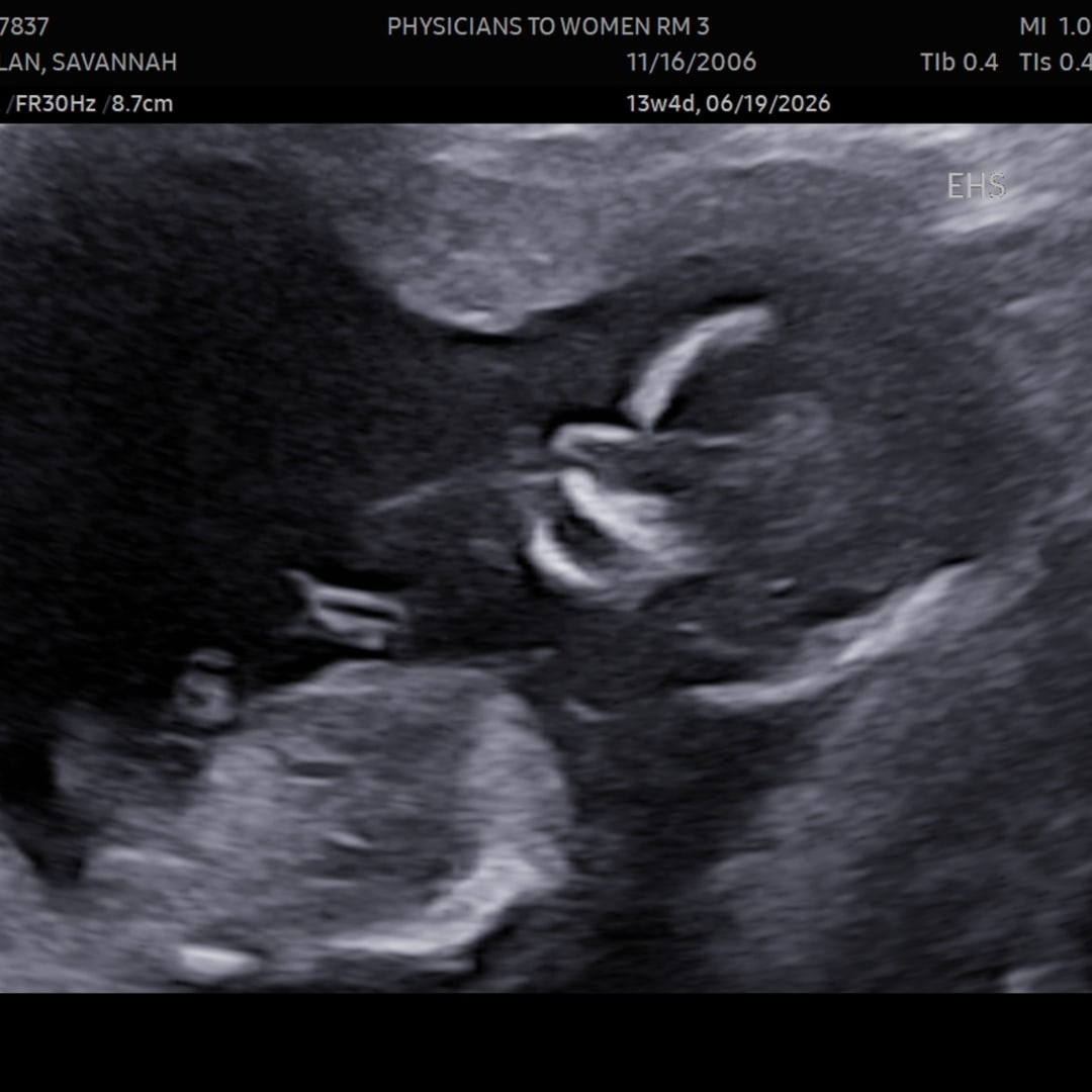 Photo shared by Savannah for their Babylist baby registry.