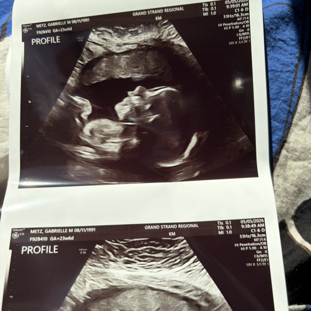 Photo shared by Gabrielle for their Babylist baby registry.
