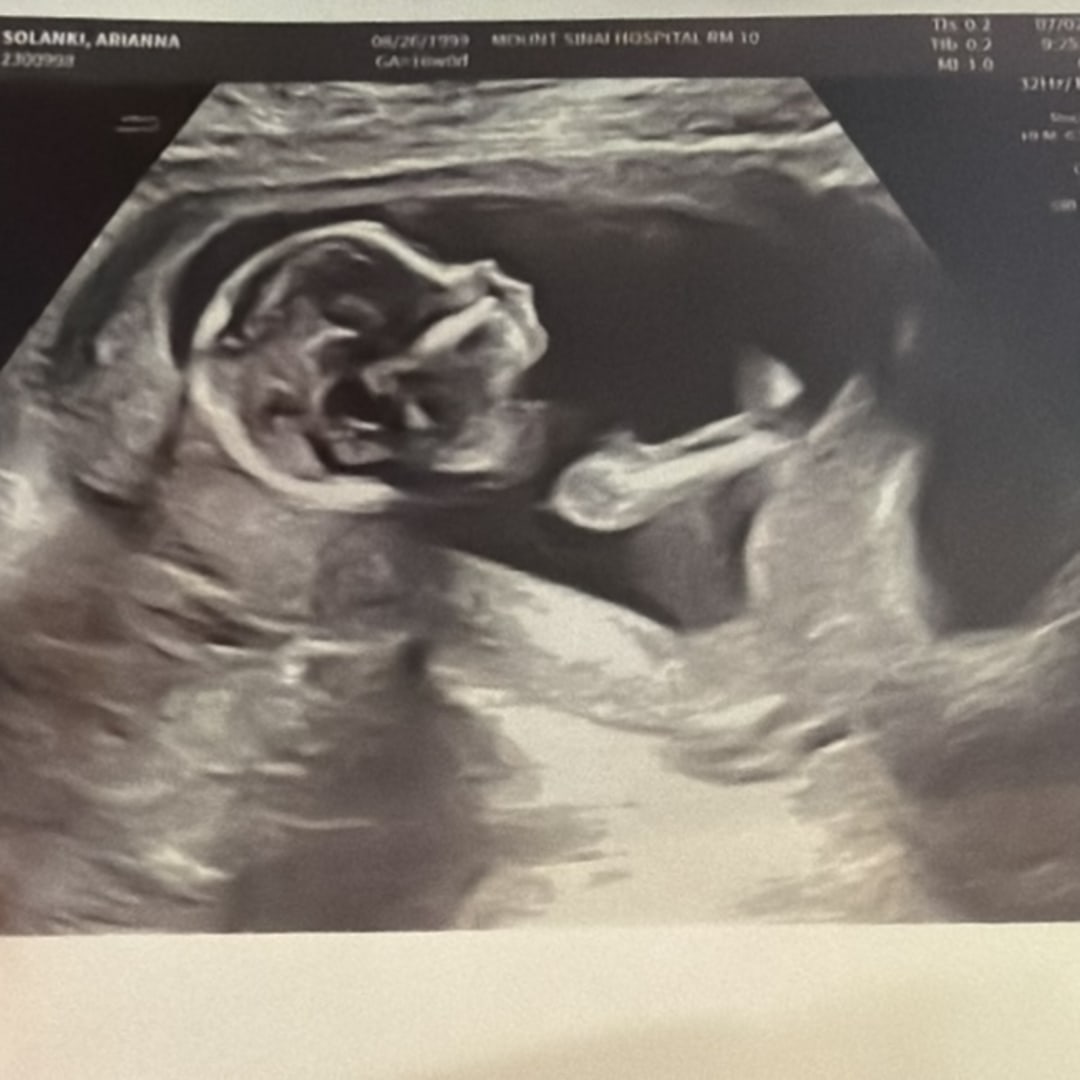 Photo shared by Arianna for their Babylist baby registry.
