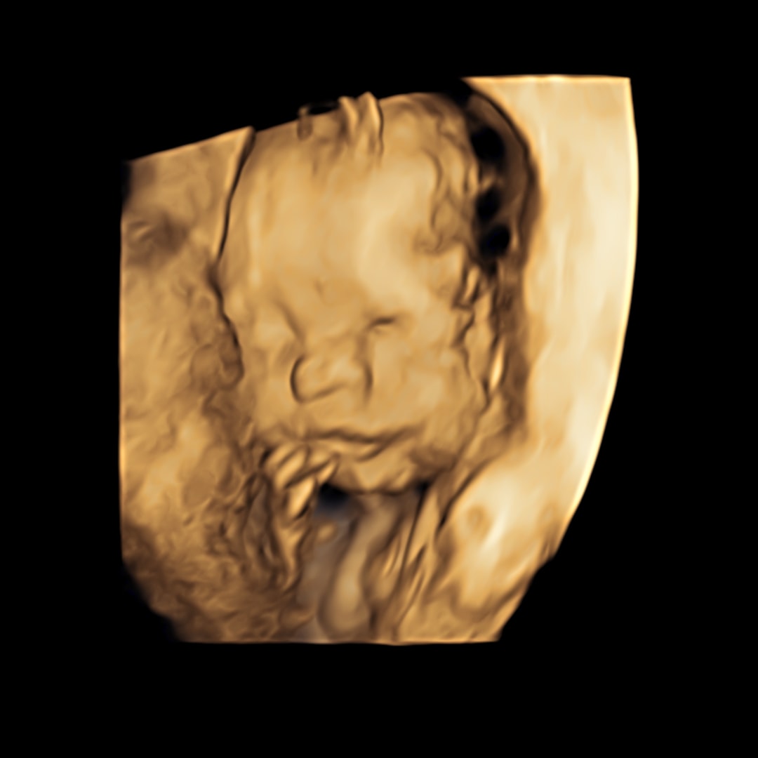 Photo shared by Rachel for their Babylist baby registry.