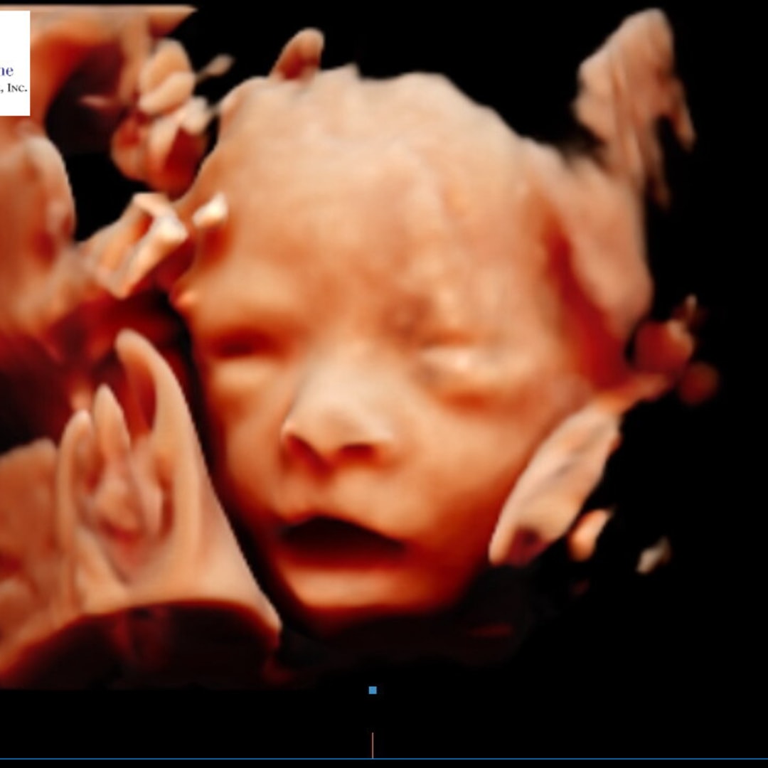 Photo shared by Kendra for their Babylist baby registry.