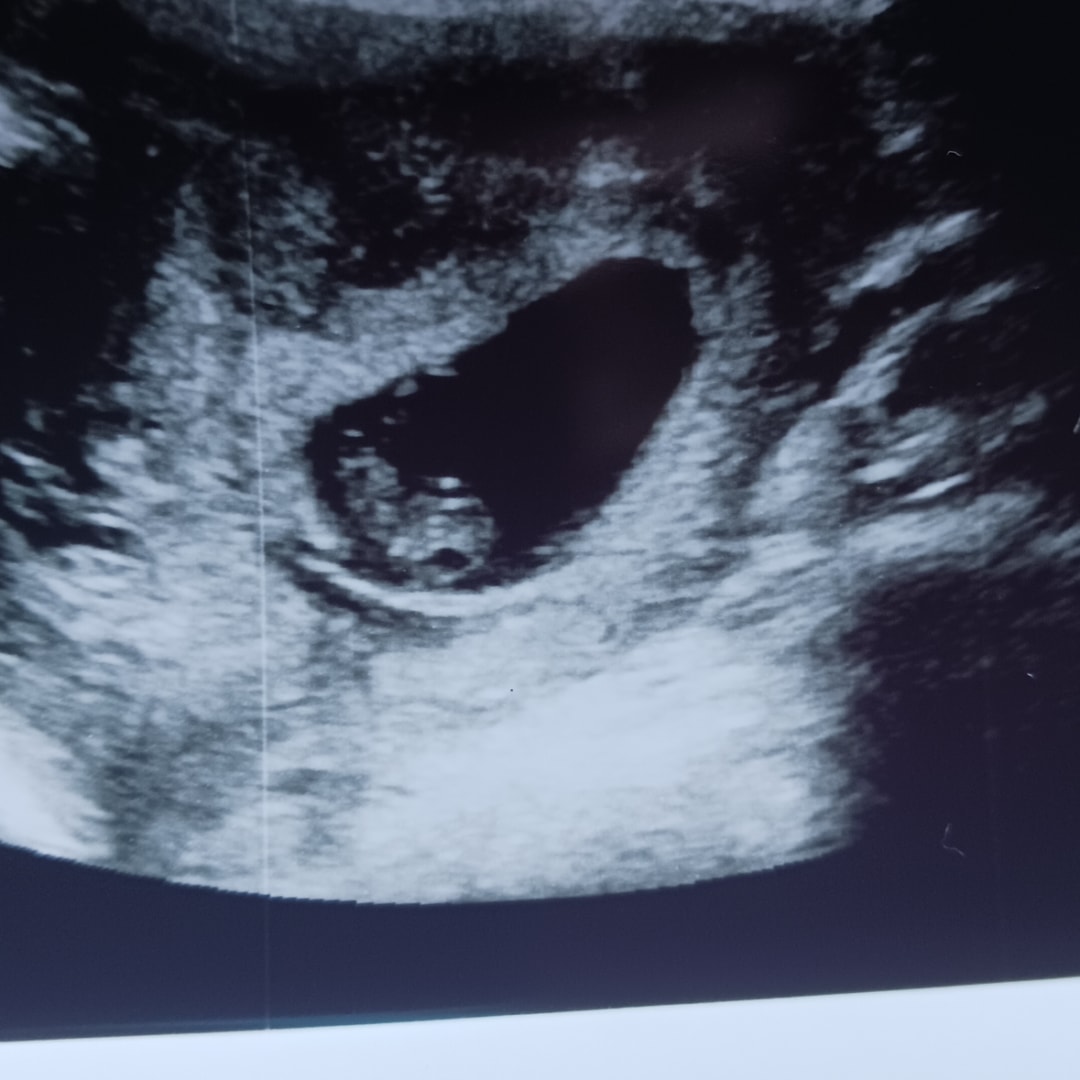 Photo shared by Heather for their Babylist baby registry.