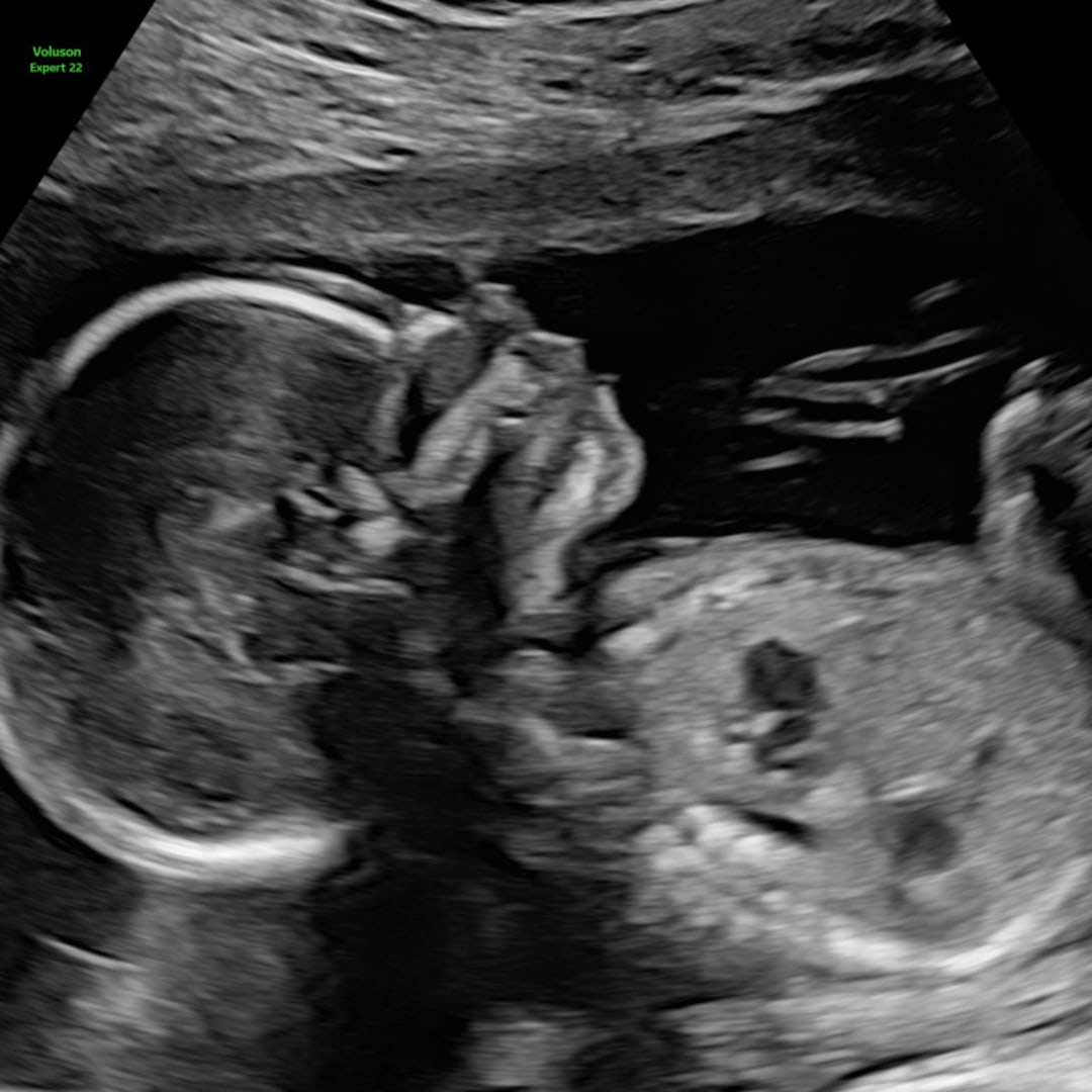 Photo shared by Isis for their Babylist baby registry.