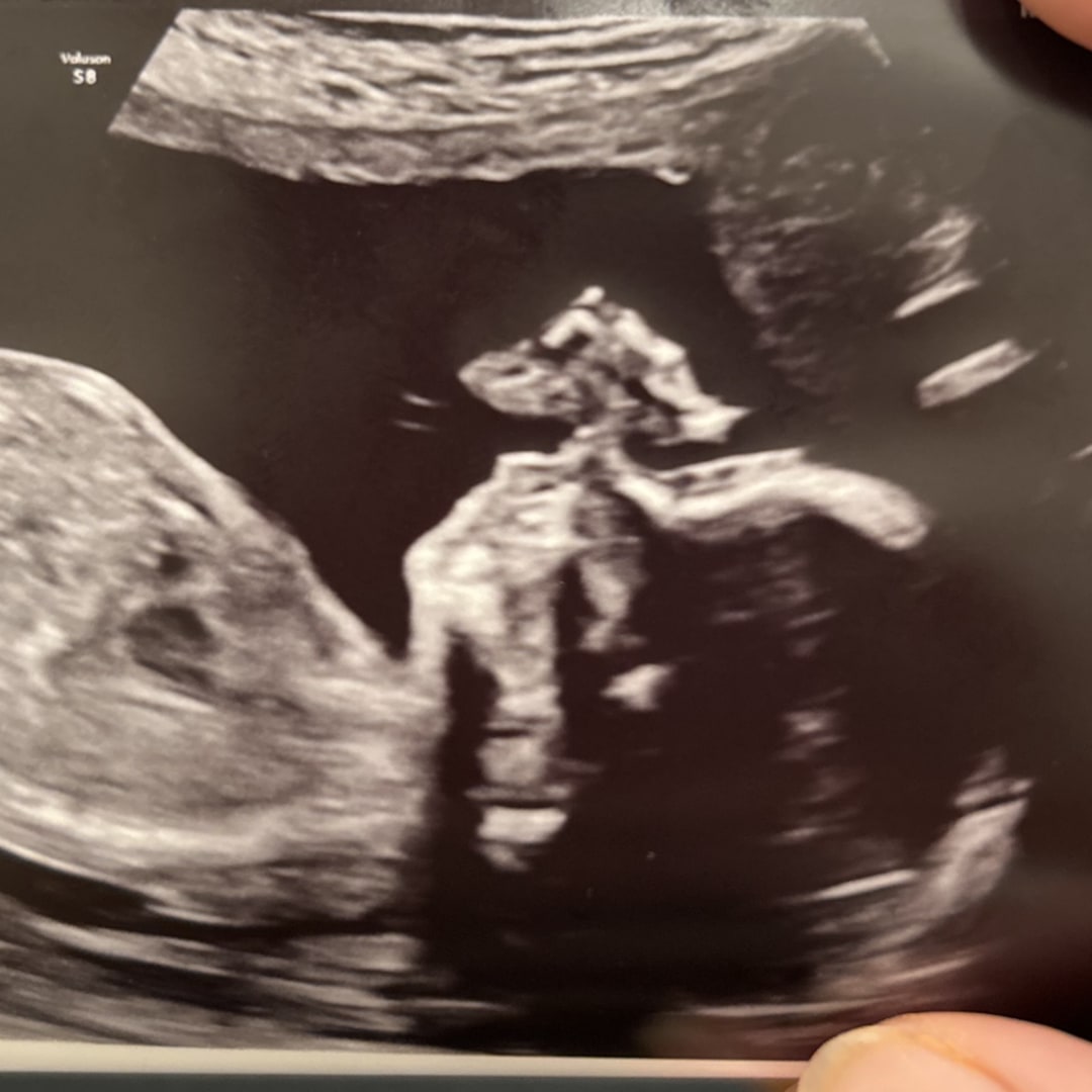 Photo shared by Andrea for their Babylist baby registry.