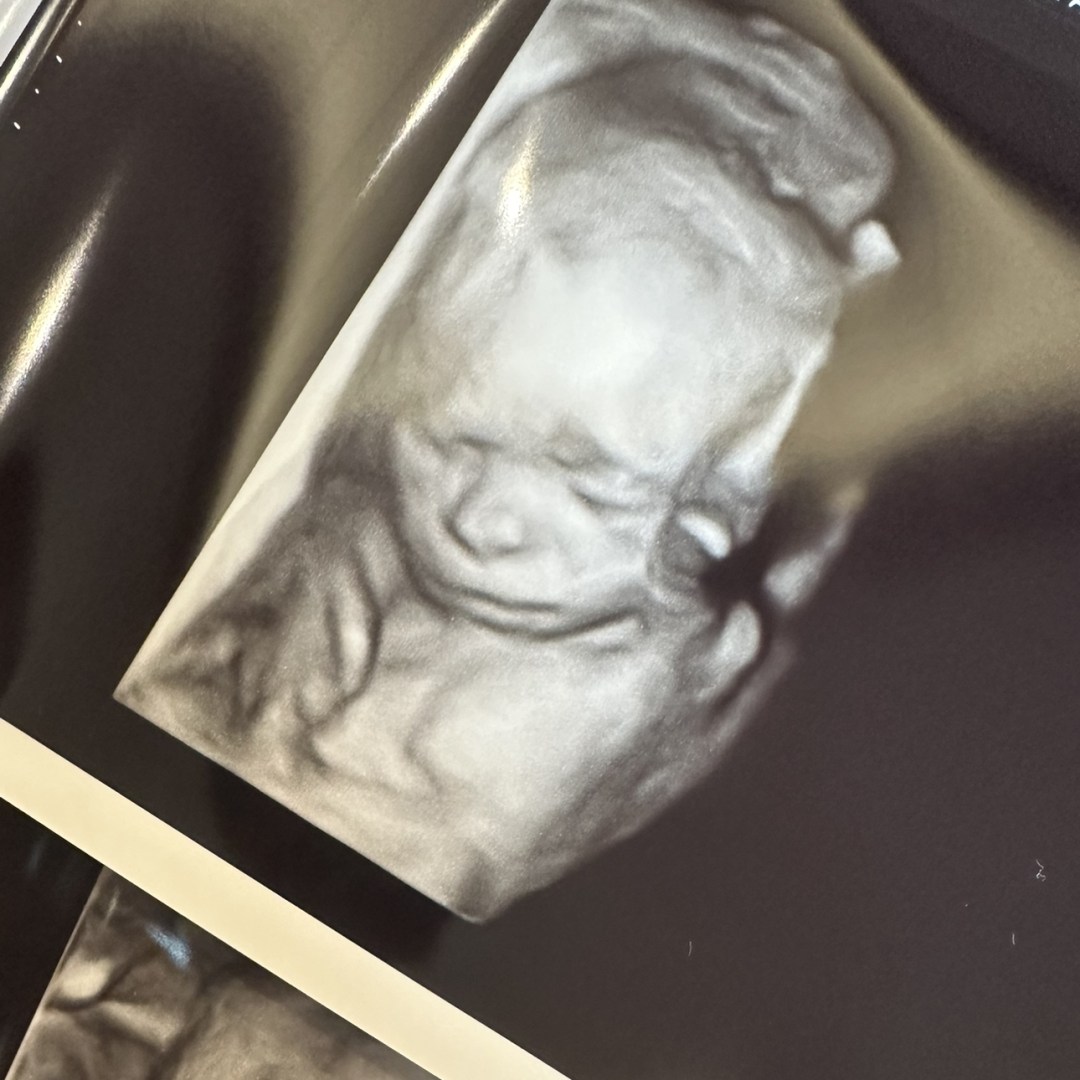 Photo shared by Haley for their Babylist baby registry.