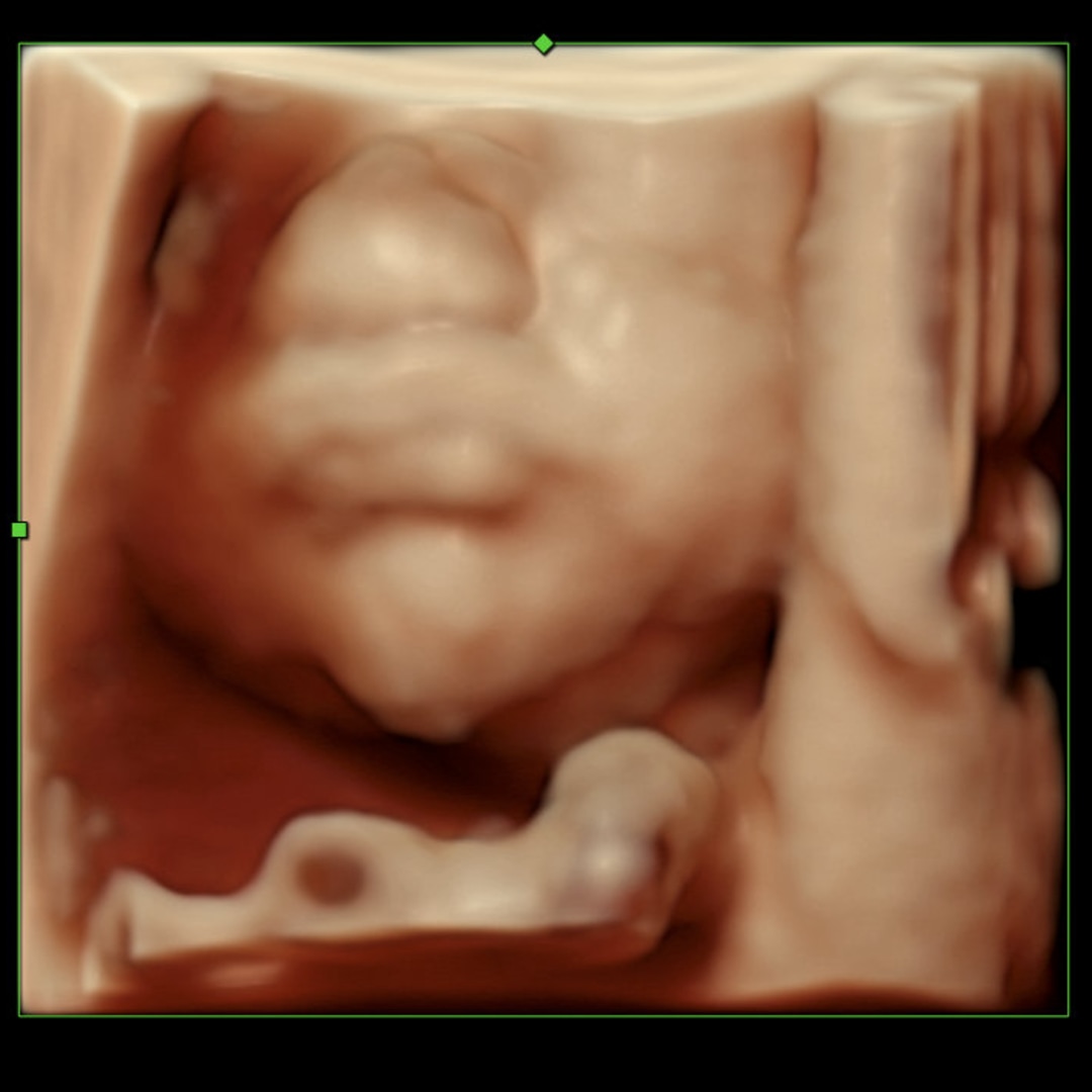 Photo shared by Sarahi for their Babylist baby registry.