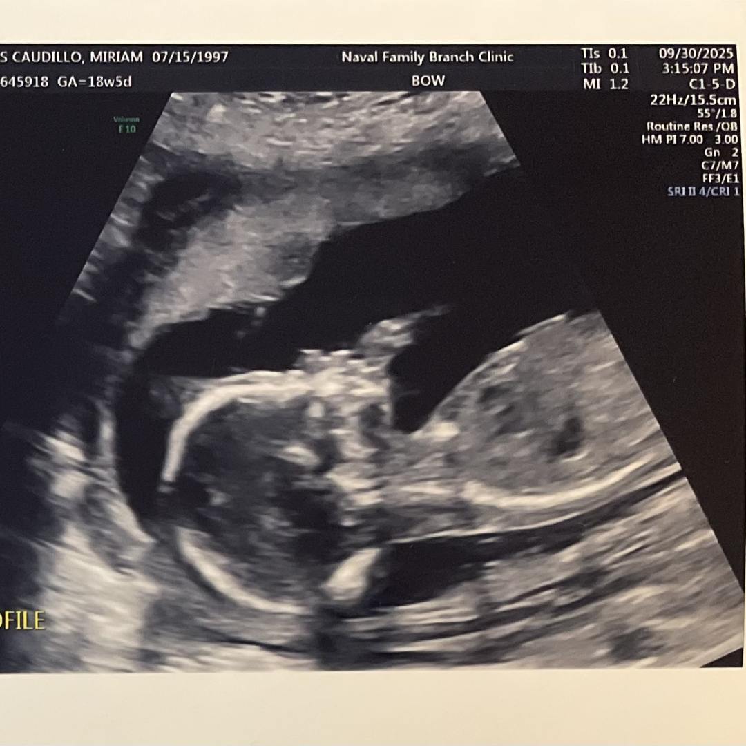 Photo shared by Miriam for their Babylist baby registry.