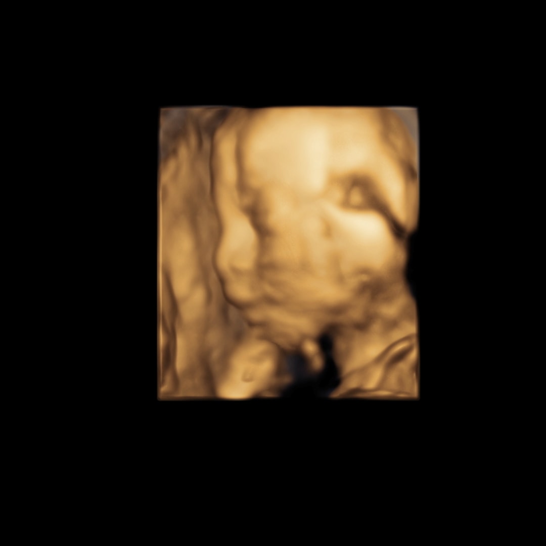 Photo shared by Breana for their Babylist baby registry.