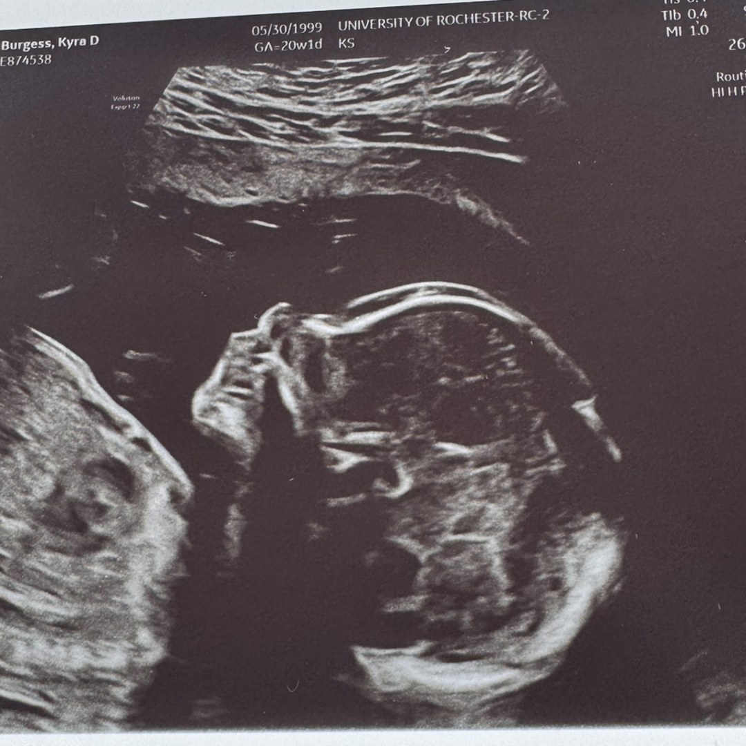 Photo shared by Kay for their Babylist baby registry.