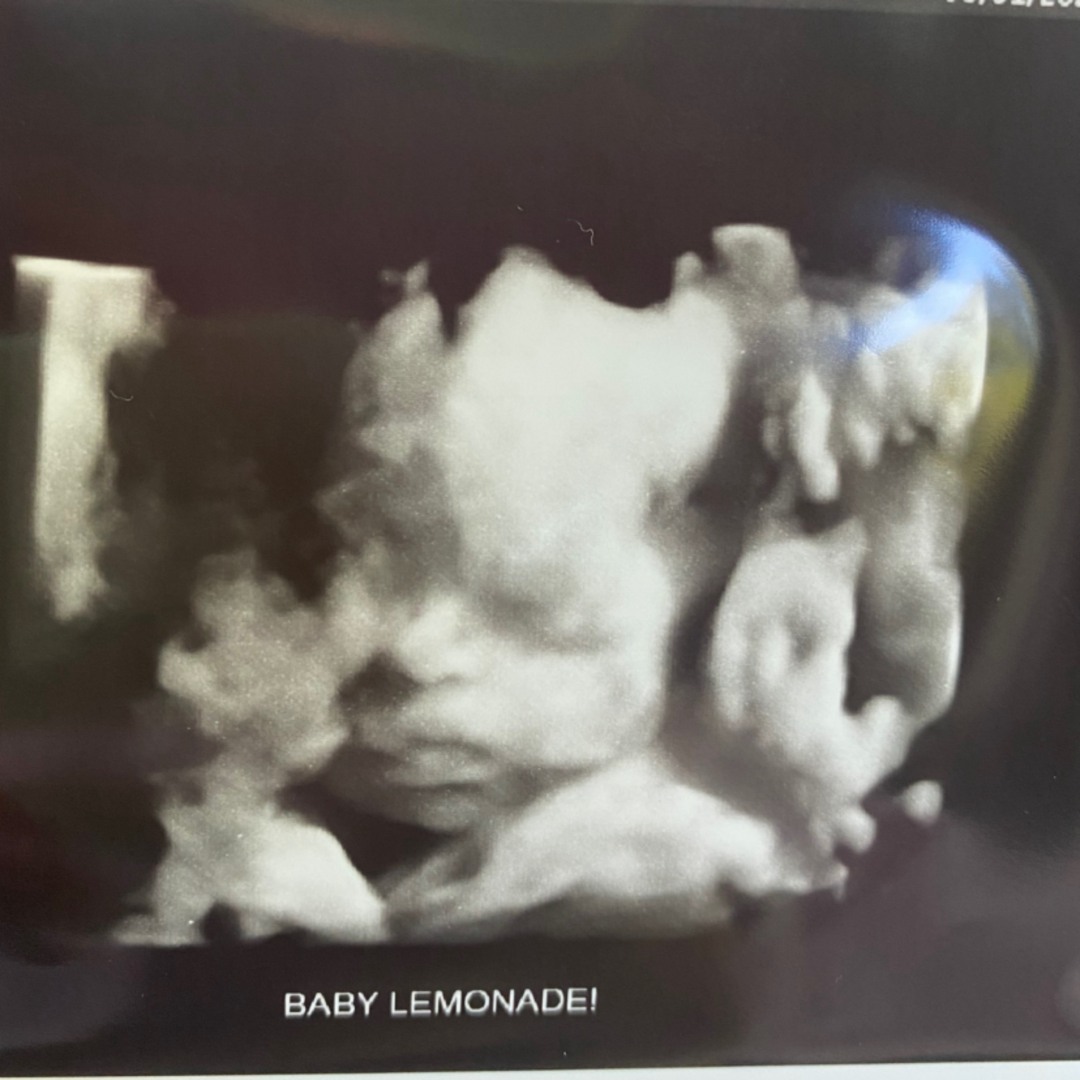 Photo shared by Tayler for their Babylist baby registry.