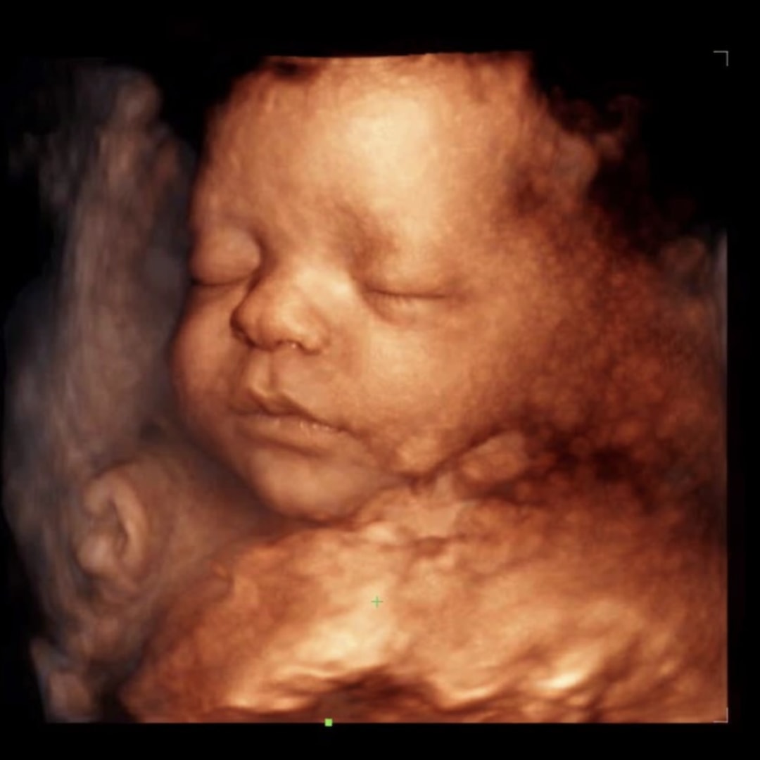 Photo shared by Kortnie for their Babylist baby registry.