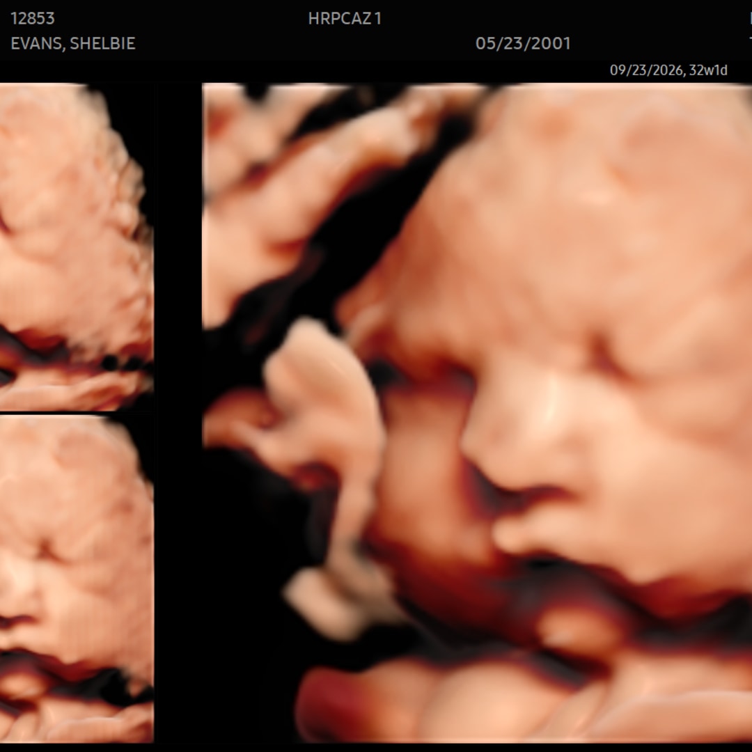 Photo shared by Shelbie for their Babylist baby registry.