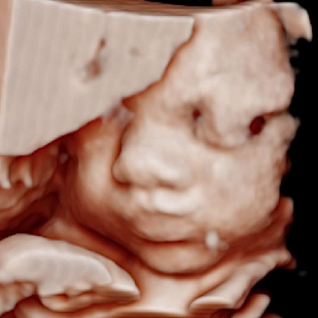 Photo shared by Elisha for their Babylist baby registry.