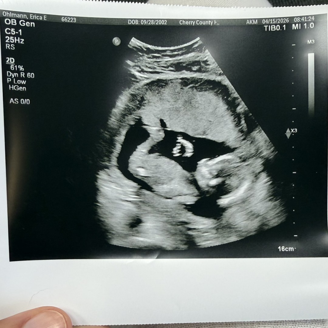 Photo shared by Erica for their Babylist baby registry.