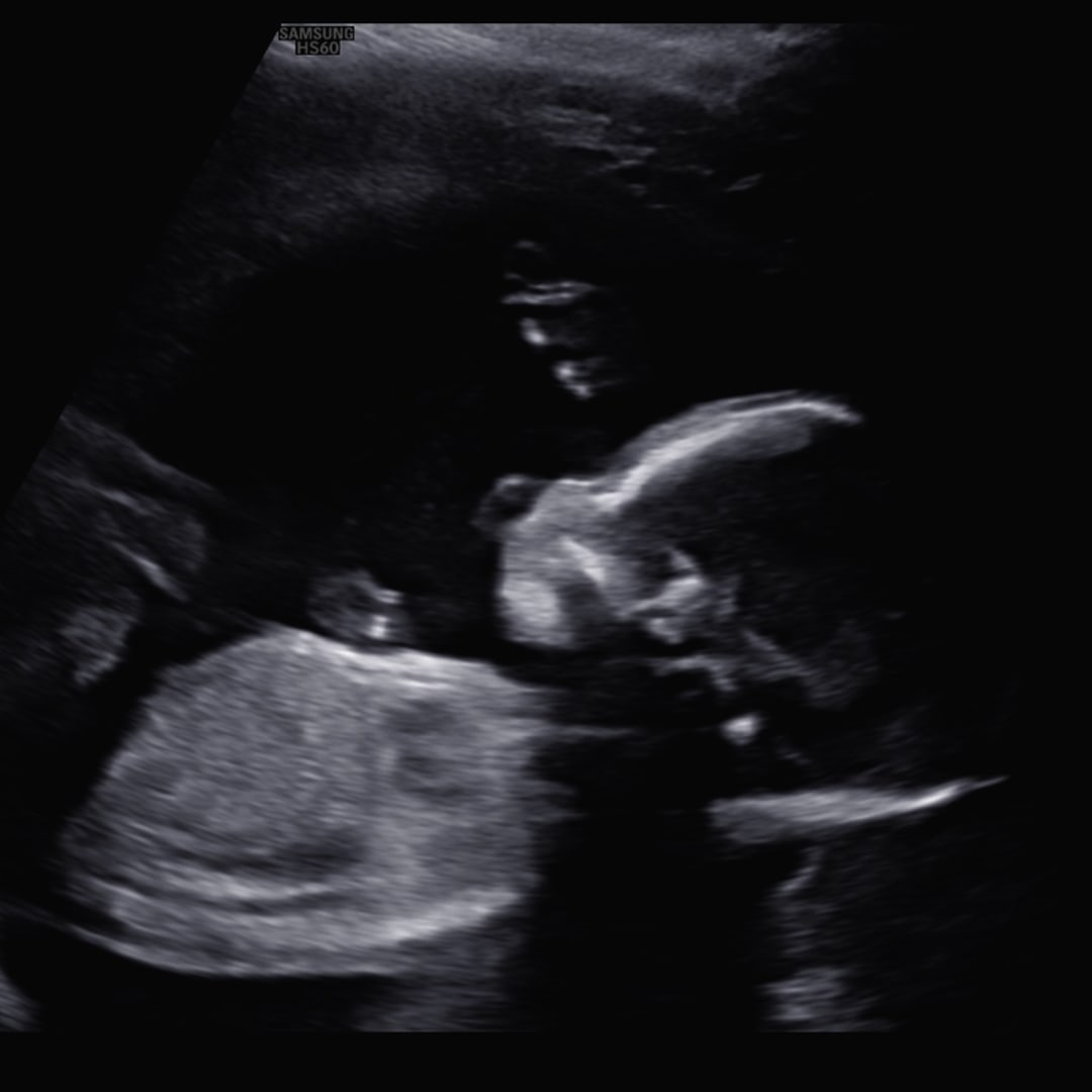 Photo shared by Bianca for their Babylist baby registry.