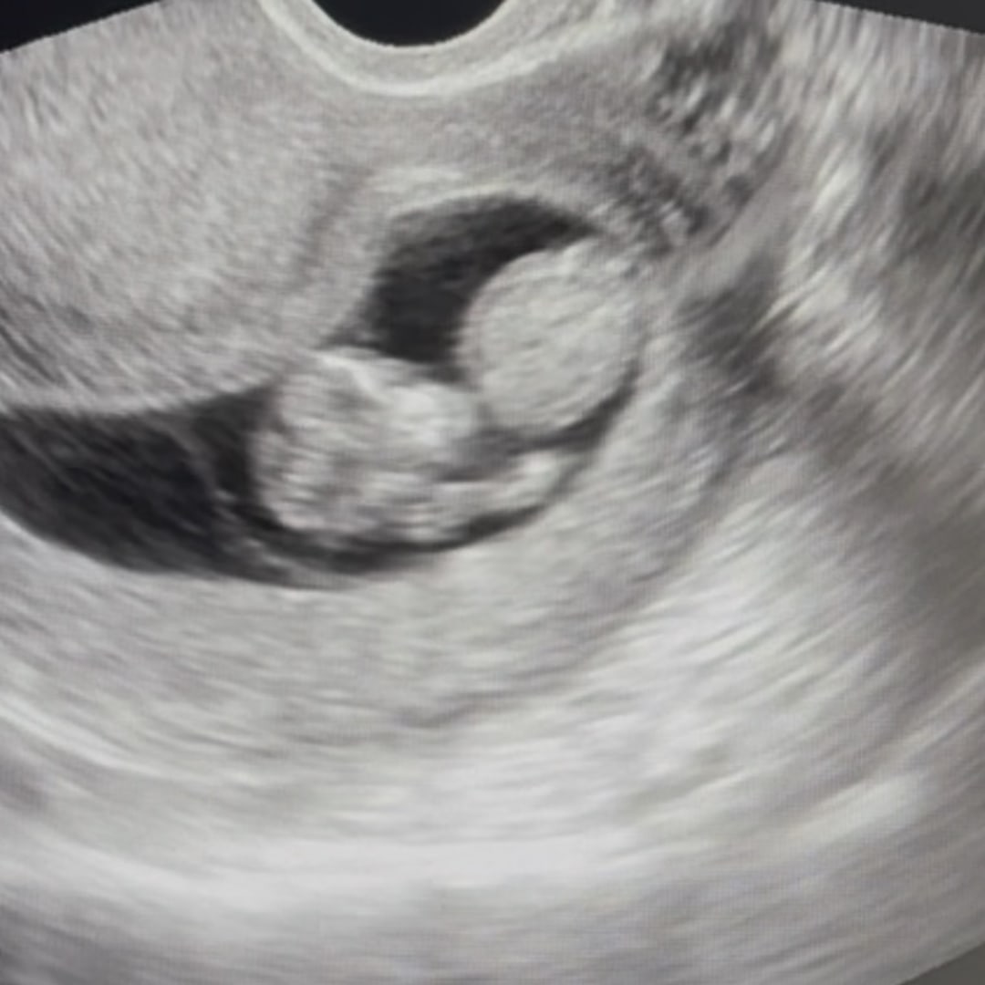Photo shared by Courtney for their Babylist baby registry.