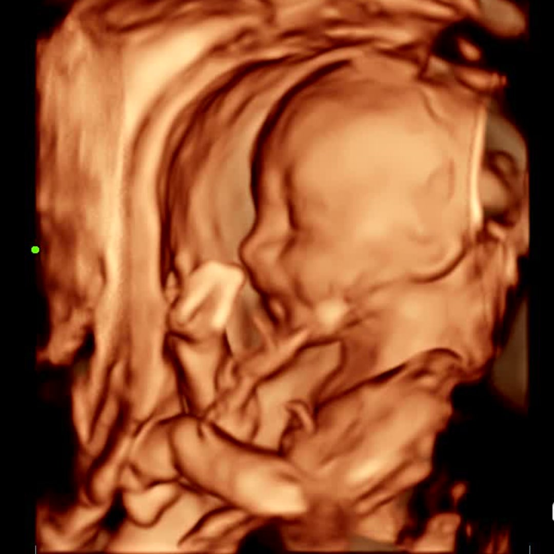 Photo shared by Lainey for their Babylist baby registry.