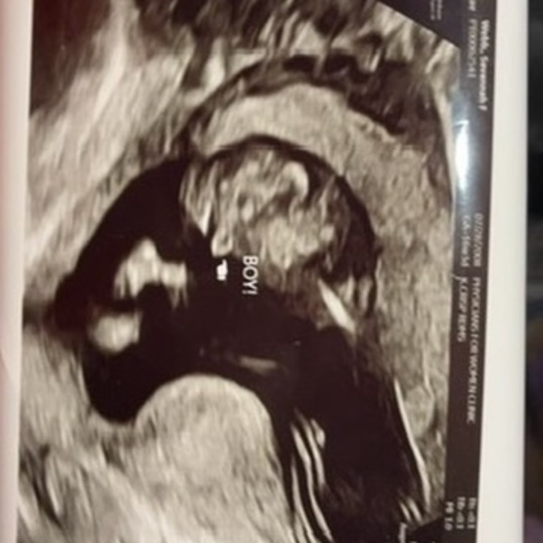 Photo shared by Savannah for their Babylist baby registry.
