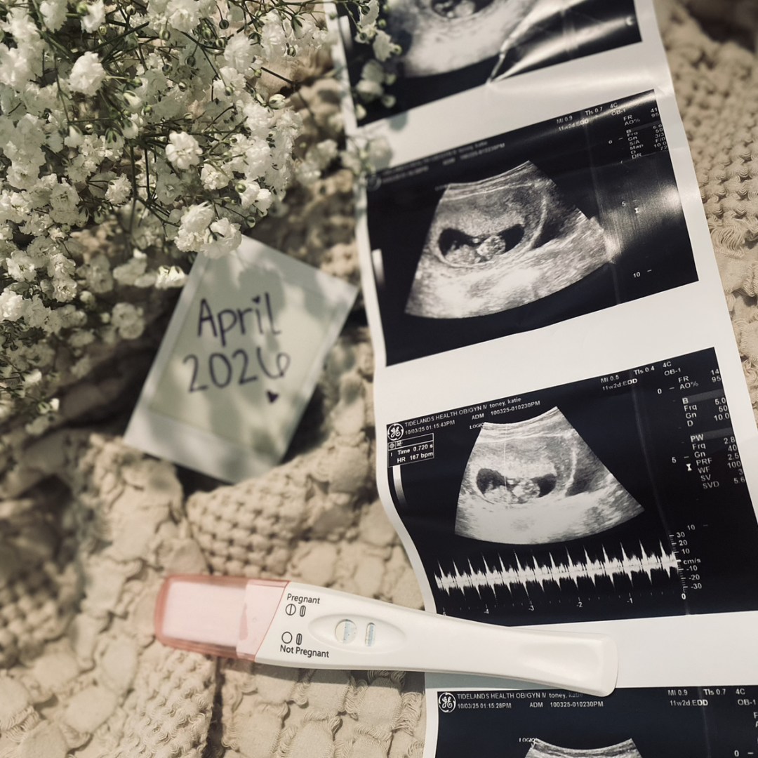 Photo shared by Katie for their Babylist baby registry.