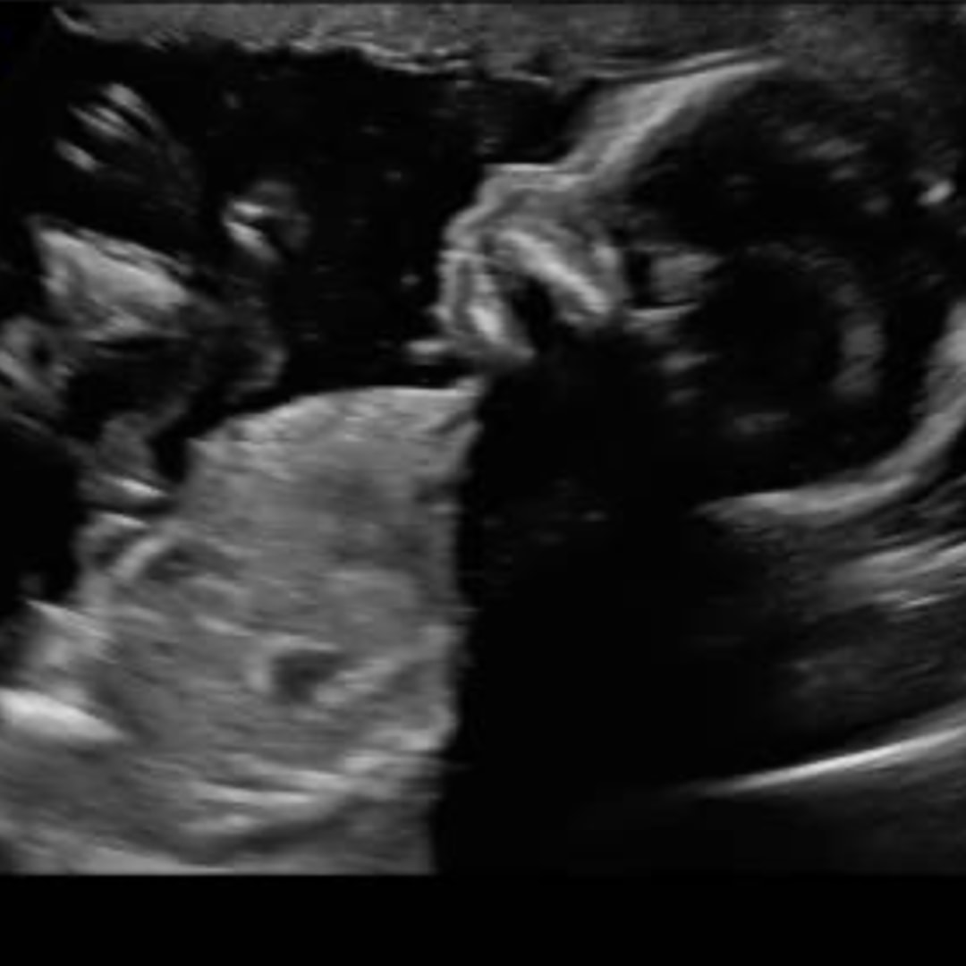 Photo shared by Zoe for their Babylist baby registry.