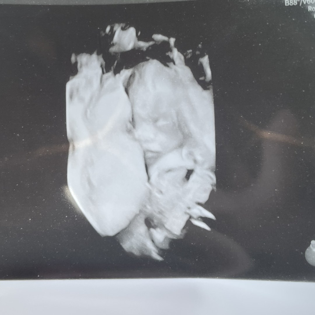 Photo shared by Emily for their Babylist baby registry.