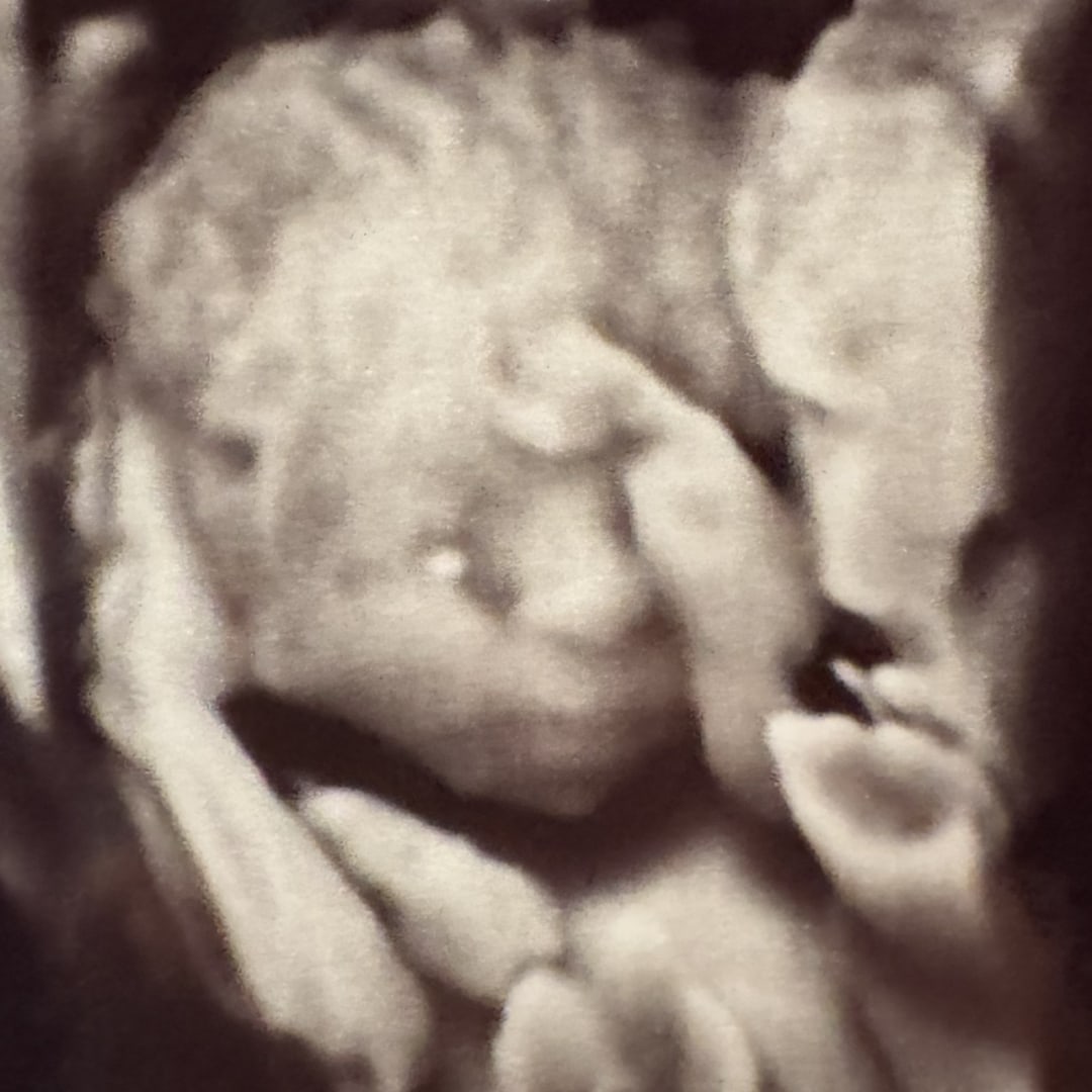 Photo shared by Anne for their Babylist baby registry.