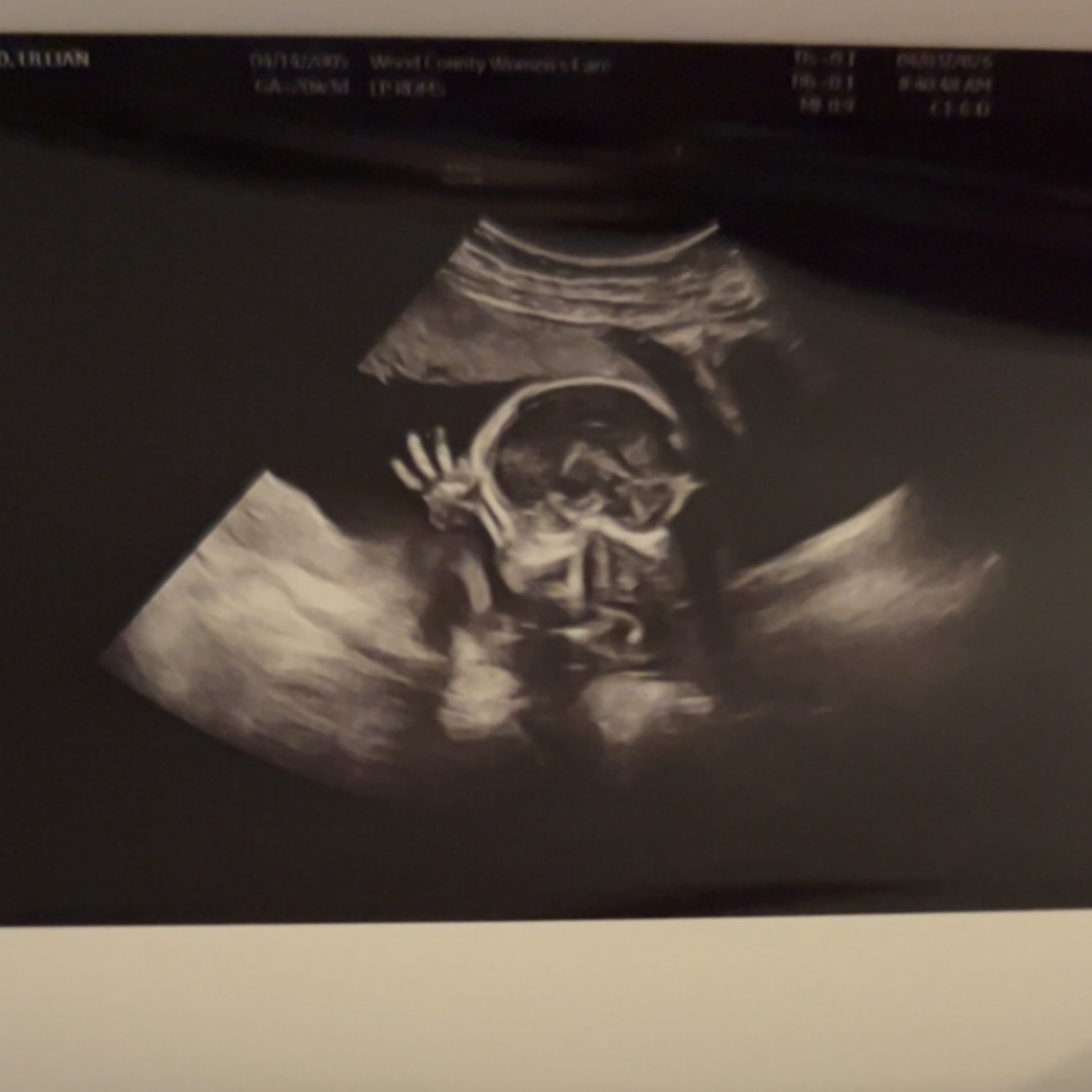 Photo shared by Lilly for their Babylist baby registry.