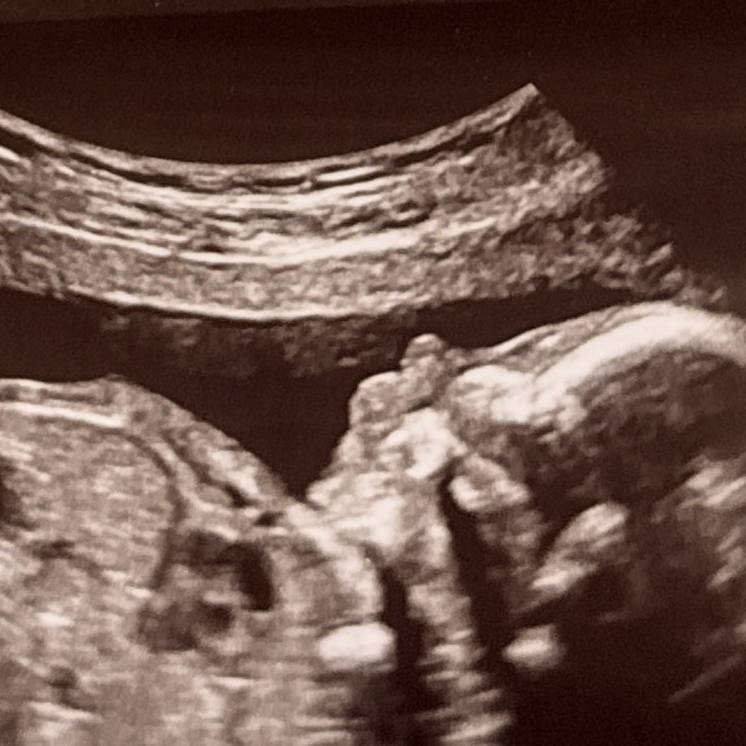 Photo shared by Lauran for their Babylist baby registry.