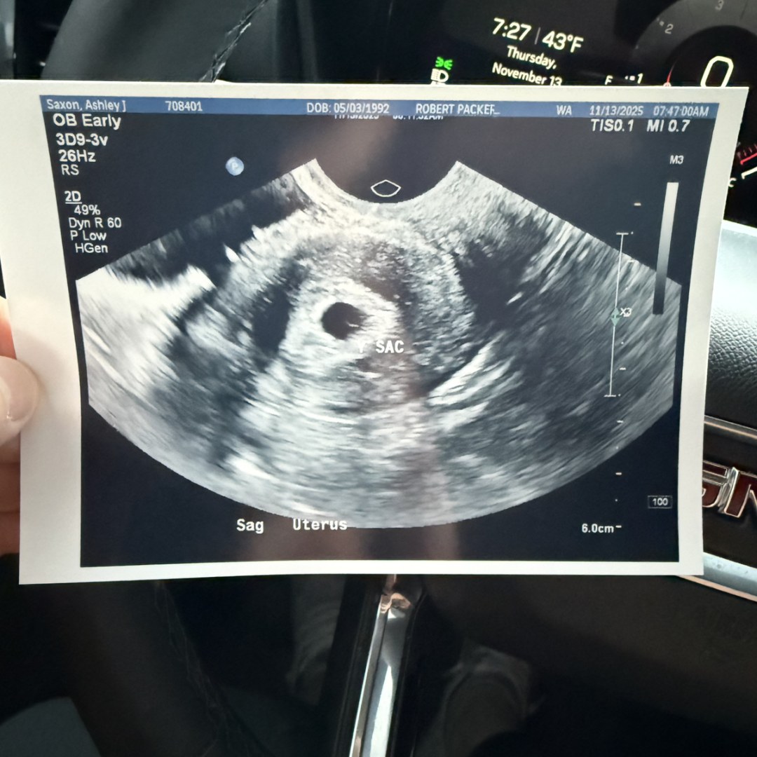 Photo shared by Joel for their Babylist baby registry.